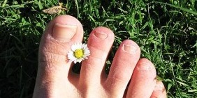 Mycose des ongles des pieds
